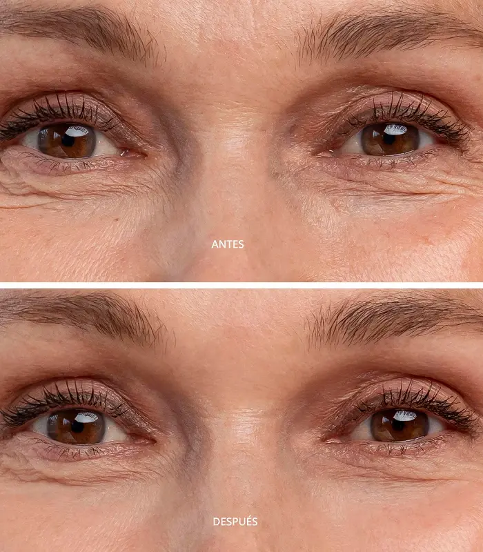 Abril et nature Contorno de Ojos hidratante para evitar las bolsas y ojeras Devoluciones gratuitas