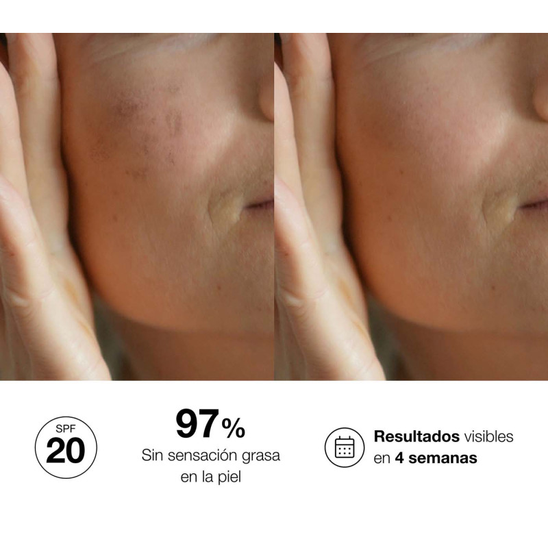 Bella Aurora bio10 forte Tratamiento despigmentante intensivo para piel mixta-grasa Ofertas especiales