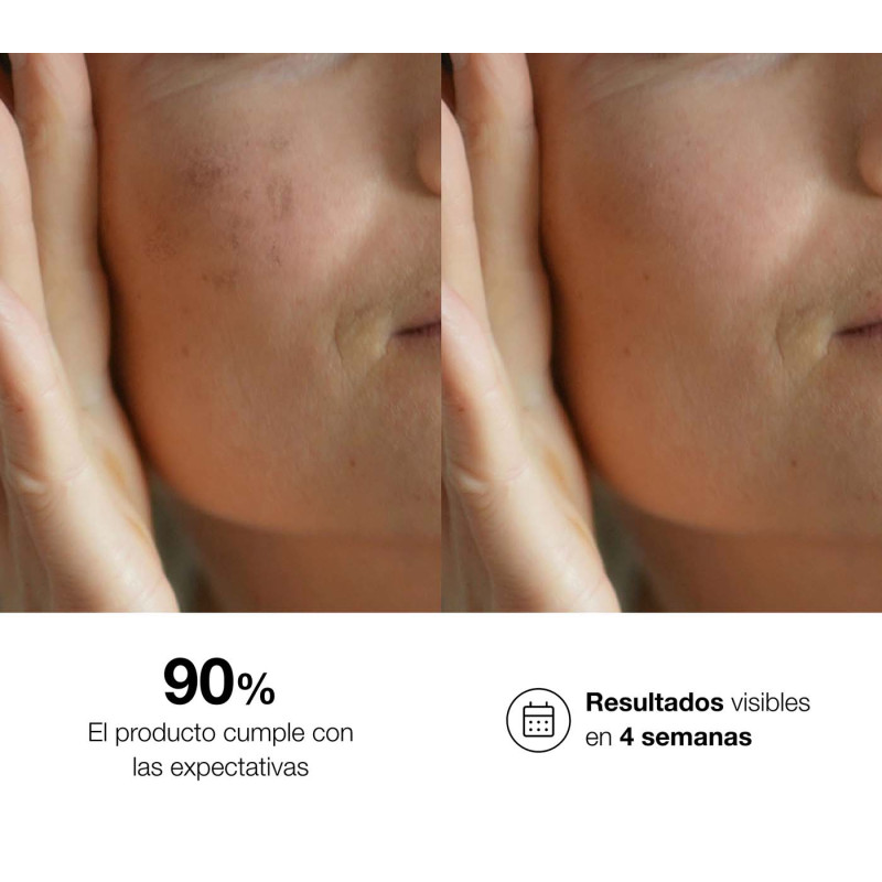 Bella Aurora bio10 forte Tratamiento despigmentante intensivo para todo tipo de piel Devoluciones gratuitas