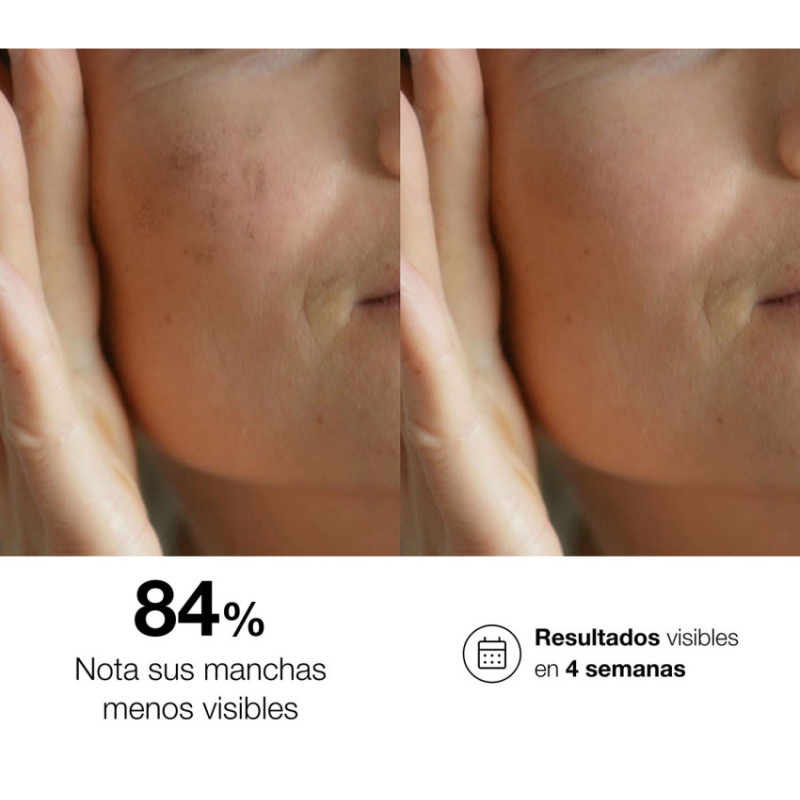 Bella Aurora Tratamiento Intensivo para Todo Tipo de Piel. bio10 forte + Noche Gran oferta