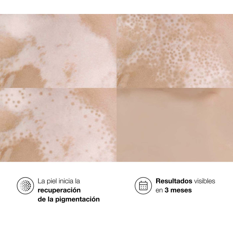 Bella Aurora Repigment12® Crema Reguladora de la pigmentación cutánea Tienda