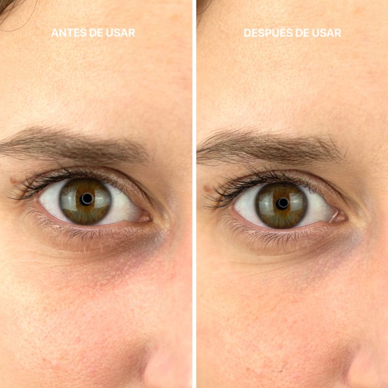 la cabine Contorno de Ojos Botulinum Effect 2025