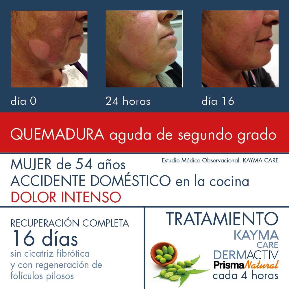 prisma natural KAYMA CARE DERMACTIV Descuentos del mes